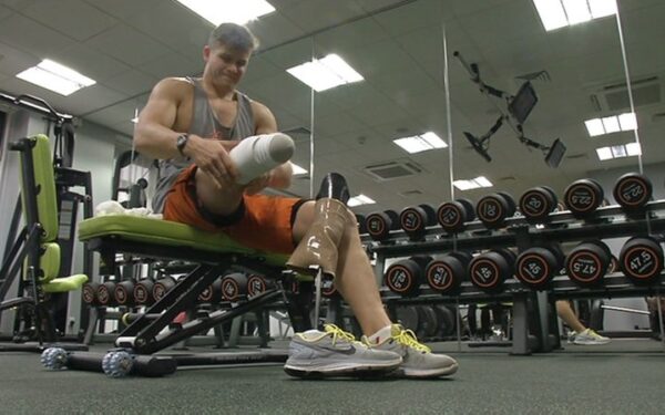 Lietuviui amputuota koja siekti fitneso čempiono titulo – ne kliūtis!