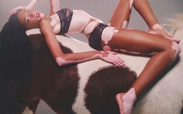 Juodai balta: reta odos liga nesutrukdė tapti modeliu (foto)