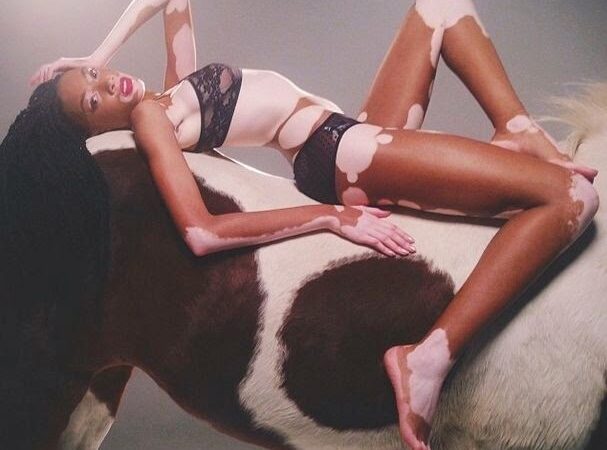 Juodai balta: reta odos liga nesutrukdė tapti modeliu (foto)