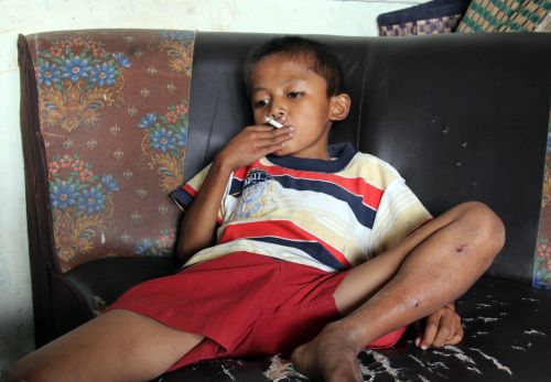 Ketverius metus rūkęs aštuonmetis Indonezijoje atsikratė potraukio nikotinui