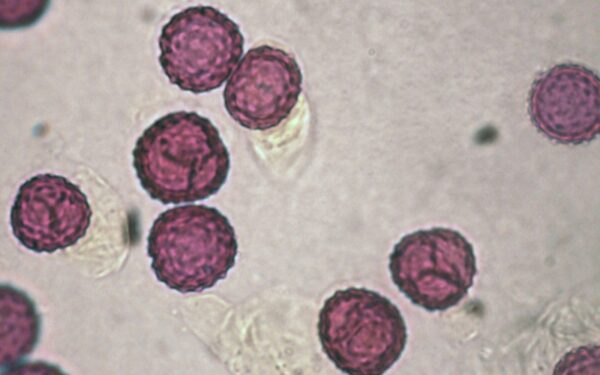 Ar žinome, ką įkvepiame su oru?