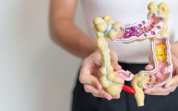 Kaip palaikyti tinkamą žarnyno sveikatą? Patarimais dalijasi dietologai