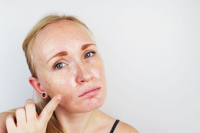 Riebios odos priežiūra: dermatologų patarimai ir gudrybės