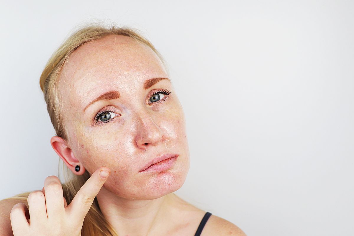Riebios odos priežiūra: dermatologų patarimai ir gudrybės