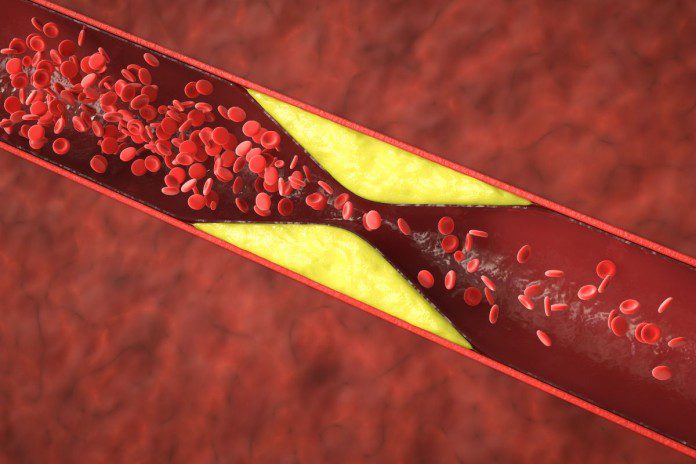 Obuoliai – natūrali pagalba mažinant cholesterolio kiekį