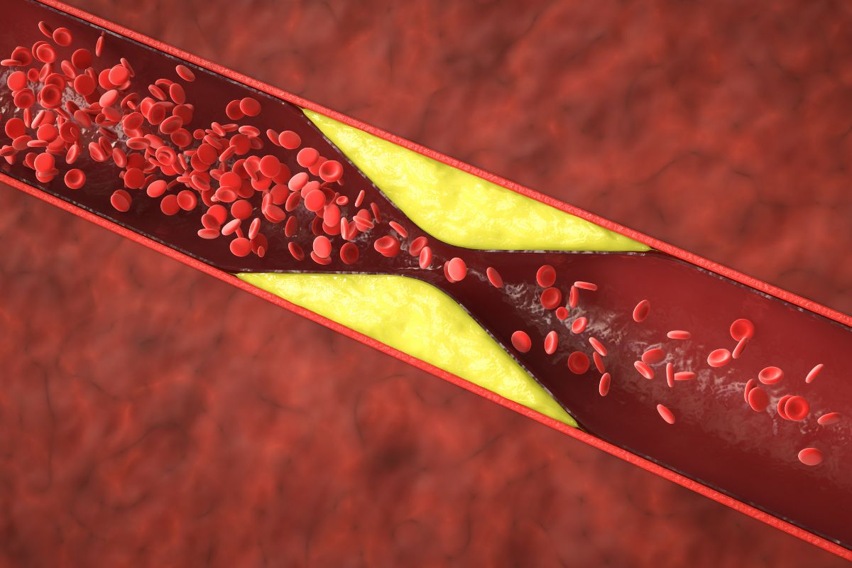 Obuoliai – natūrali pagalba mažinant cholesterolio kiekį