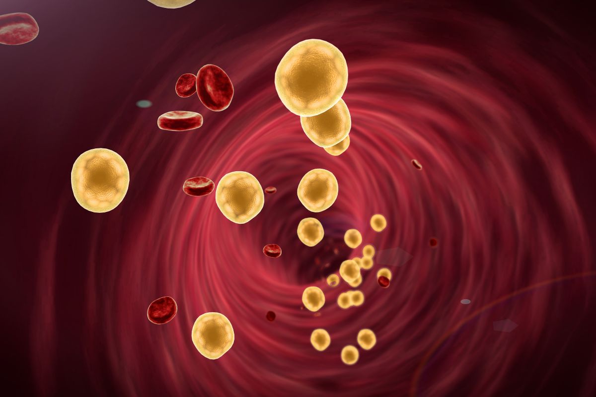 Naujas tyrimas atskleidžia ryšį tarp cholesterolio ir demencijos rizikos