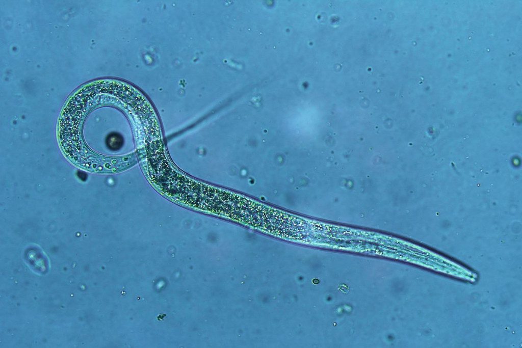 Sios-priemones-pades-atsikratyti-grambuoliu-is-sodo-akimirksniu-nematodai - Laikas.lt Šios priemonės padės atsikratyti grambuolių iš sodo akimirksniu. Nematodai