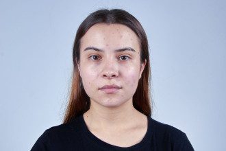 Ar riebi oda iš tiesų lėčiau sensta? Dermatologų atsakymai gali nustebinti