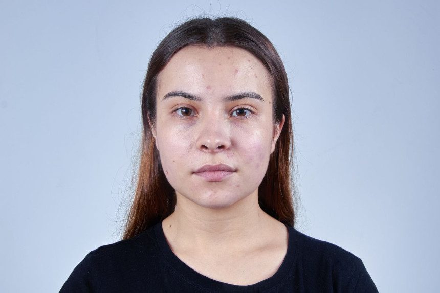 Ar riebi oda iš tiesų lėčiau sensta? Dermatologų atsakymai gali nustebinti