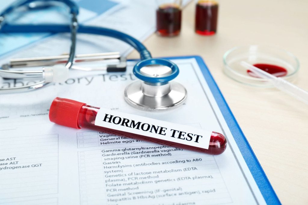 kaip-atpazinti-padidejusi-lytinius-hormonus-sujungiancio-globulino-kieki - Laikas.lt Kaip atpažinti padidėjusį lytinius hormonus sujungiančio globulino kiekį?