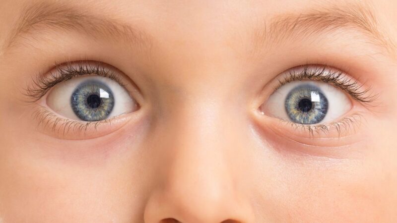 5 akių požymiai, kurie gali išduoti rimtas sveikatos problemas