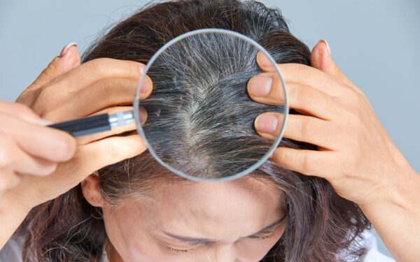 Stilistė atskleidė stulbinančią gudrybę: taip paslėpsite visus žilus plaukus be dažų