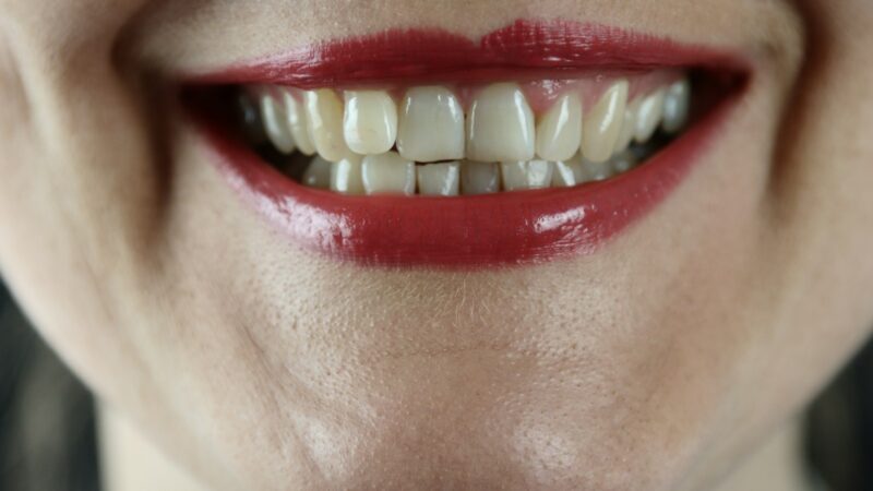 Tai ne tik šypsena: pasakė, ką jūsų dantų būklė sako apie sveikatą ir gyvenimo trukmę