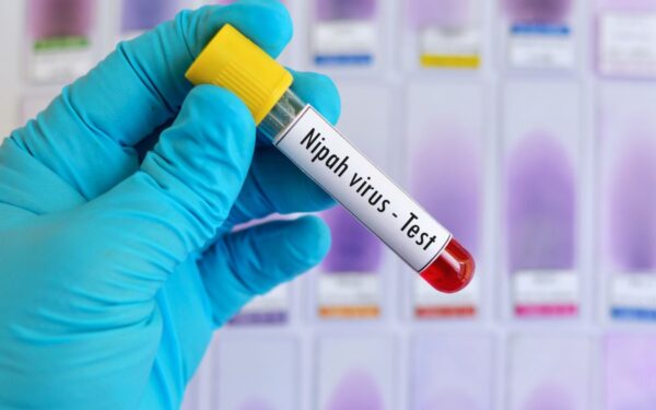 Mirštamumas iki 75 proc., gydymo nėra: ECDC paaiškino, ar Nipos virusas gresia Europai