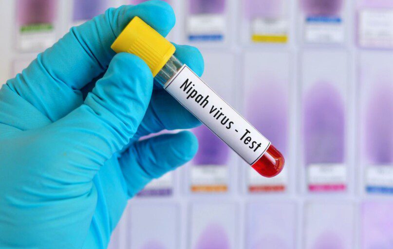 Nipah Nipos virusas