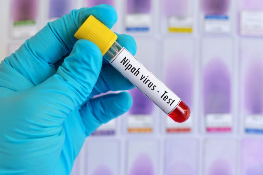 Nipah Nipos virusas