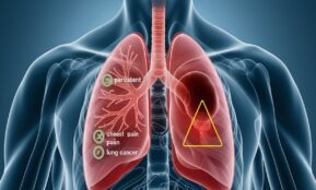 Nuolatinis kosulys – kada kreiptis į gydytoją ir kokie vėžio simptomai