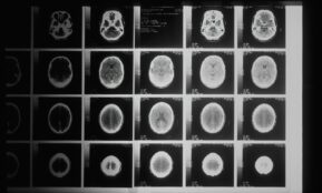 a black and white photo of various mri images
