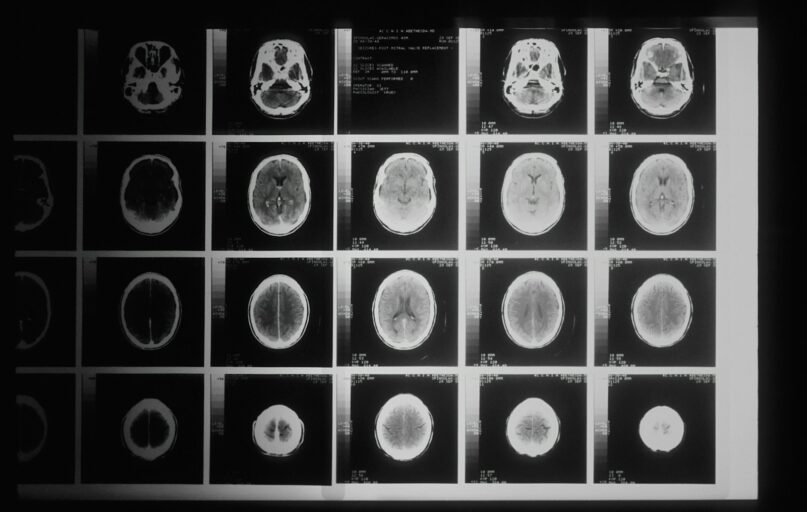 a black and white photo of various mri images