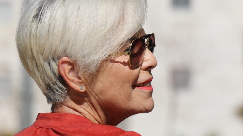 Paaiškėjo, jog žilstate visai ne dėl amžiaus: specialistai atskleidė, kokių vitaminų trūkumas keičia spalvą