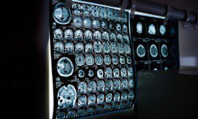 x-ray, mri, ct scan, computed tomography, magnetic resonance imaging, medicine, neurology, healthcare, x-ray, mri, mri, mri, mri, mri, ct scan, medicine, neurology, neurology, healthcare, healthcare