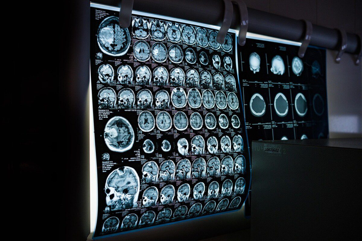 x-ray, mri, ct scan, computed tomography, magnetic resonance imaging, medicine, neurology, healthcare, x-ray, mri, mri, mri, mri, mri, ct scan, medicine, neurology, neurology, healthcare, healthcare