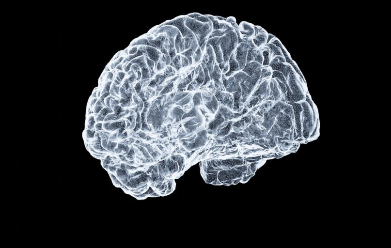 a close up of a human brain on a black background