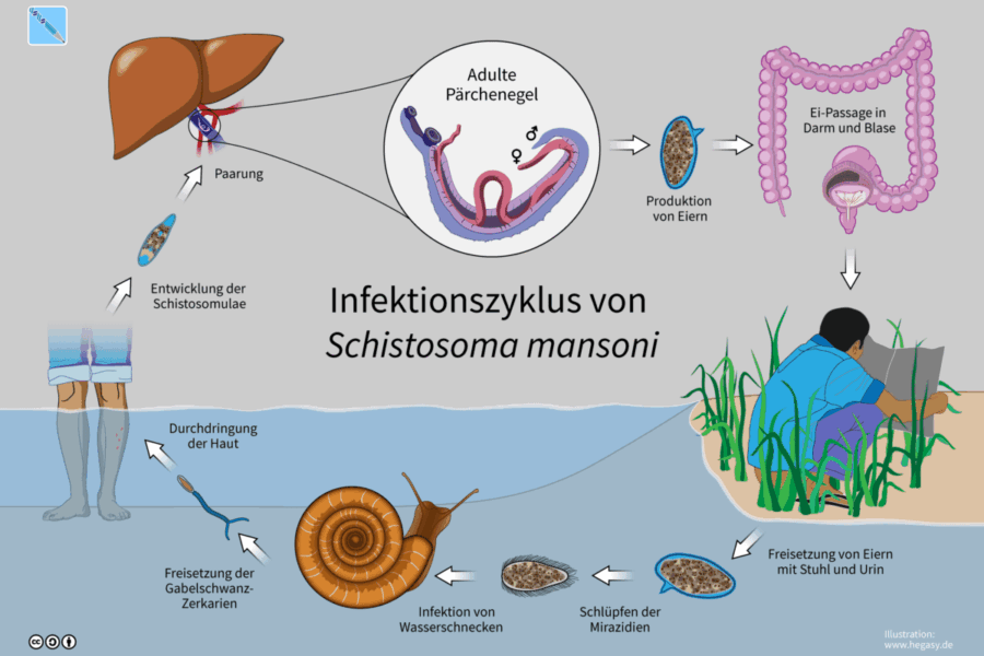 Milžiniška klimato kainos įtaka: masiškai plinta ši liga, tai būtina žinoti kiekvienam mūsų