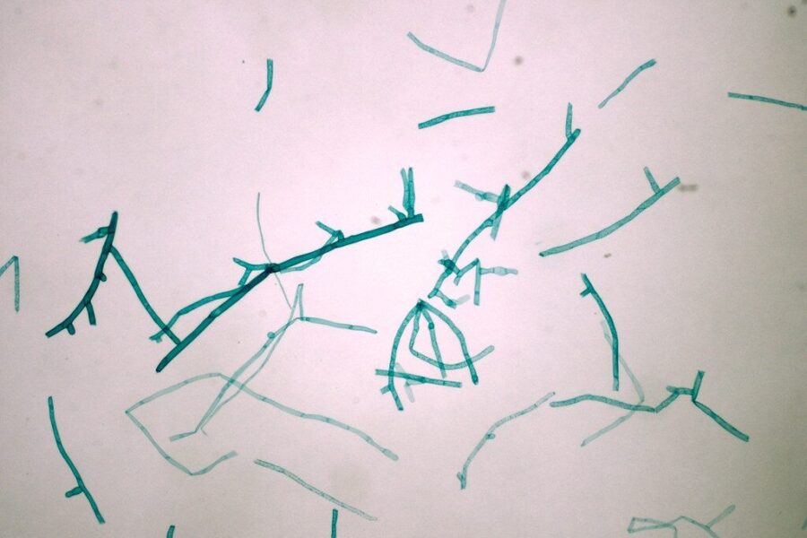 Mokslas prieš nusikaltimą: samanos padėjo išaiškinti skandalingą palaikų išniekinimą JAV