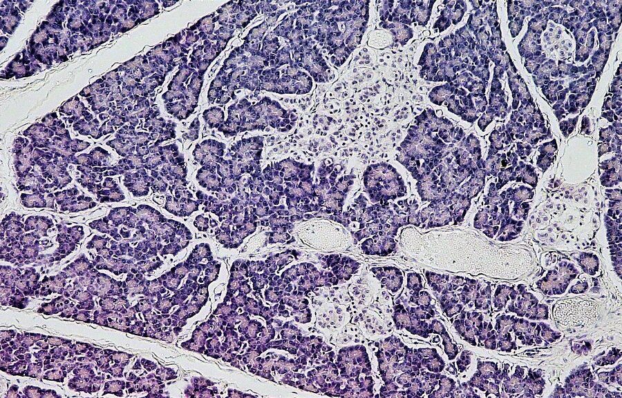 Kasos sveikata prasideda lėkštėje: gydytojai paaiškino, kokie mitybos įpročiai ją žaloja labiausiai
