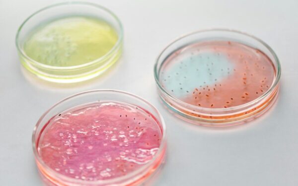 Meningito protrūkis „Kento universitete“: skaudžiai išryškėjo spragos skiepijimo politikoje