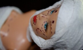 Conceptual image of a mannequin depicting plastic surgery with marker lines.