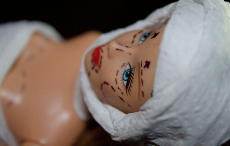 Conceptual image of a mannequin depicting plastic surgery with marker lines.