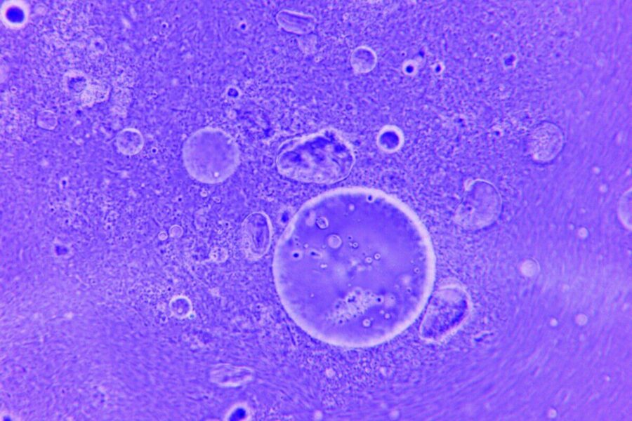 Bekontaktė kontrolė: skysčio sukimo momentas atveria kelią švelniai ir tiksliai mikromanipuliacijai