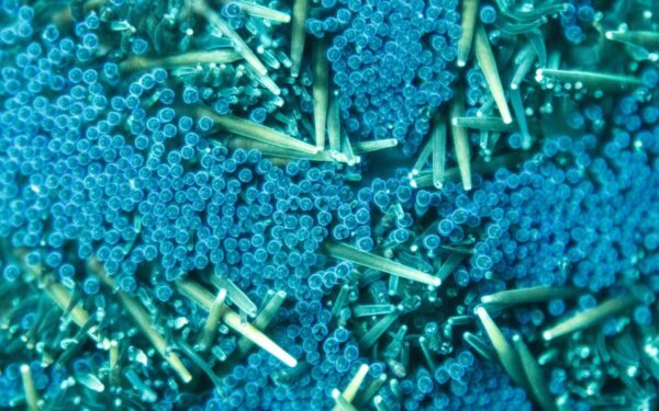 Mikroplastiko dalelės gali pasiekti smegenis: mokslininkai nagrinėja galimą ryšį su Parkinsono liga