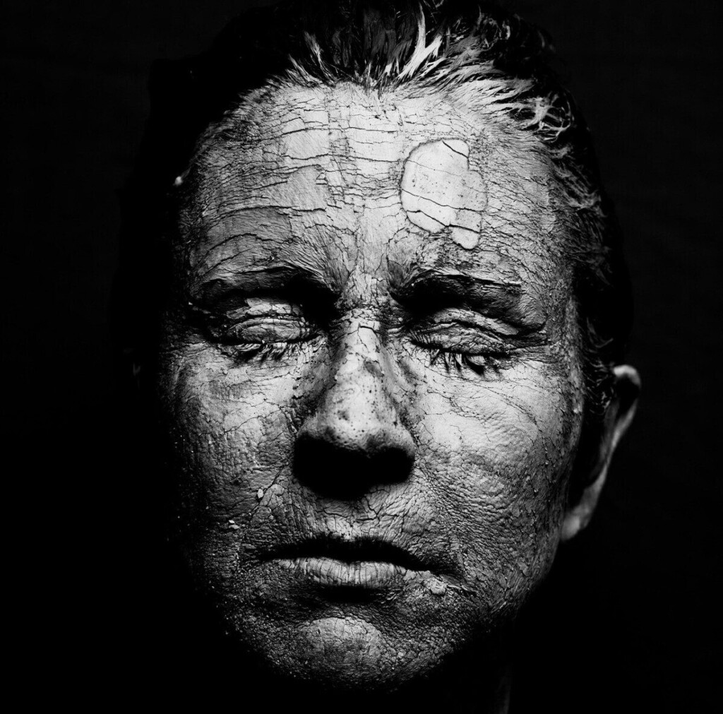 woman, dry skin, face, cracks, portrait, black and white, dry skin, dry skin, dry skin, dry skin, dry skin