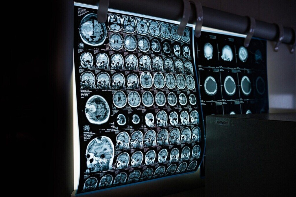 x-ray, mri, ct scan, computed tomography, magnetic resonance imaging, medicine, neurology, healthcare, x-ray, mri, mri, mri, mri, mri, ct scan, medicine, neurology, neurology, healthcare, healthcare