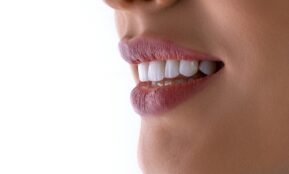 a close up of a woman's mouth with white teeth