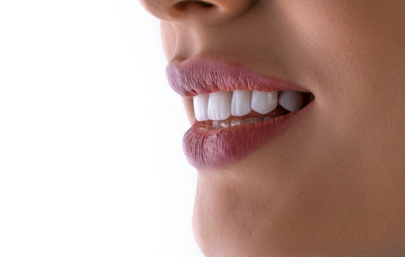 a close up of a woman's mouth with white teeth