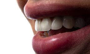 a close-up of a person's mouth with teeth showing