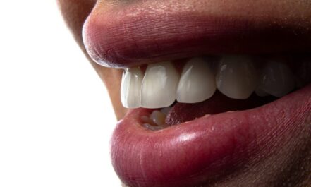 a close-up of a person's mouth with teeth showing