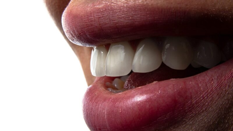 Burnos vėžys smogia tyliai: ženklai, kuriuos daugelis ignoruoja iki paskutinės stadijos