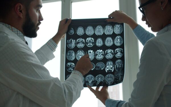 MRT tyrimų rezultatai šokiruoja: paprastas pratimas pastebimai atjaunina smegenis