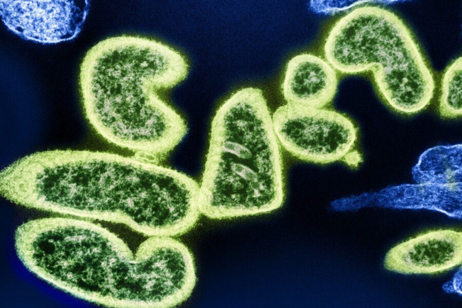 Virusas, kuriam nėra jokios vakcinos: dėl mirtino Nipah viruso Azija užveria vartus keliautojams