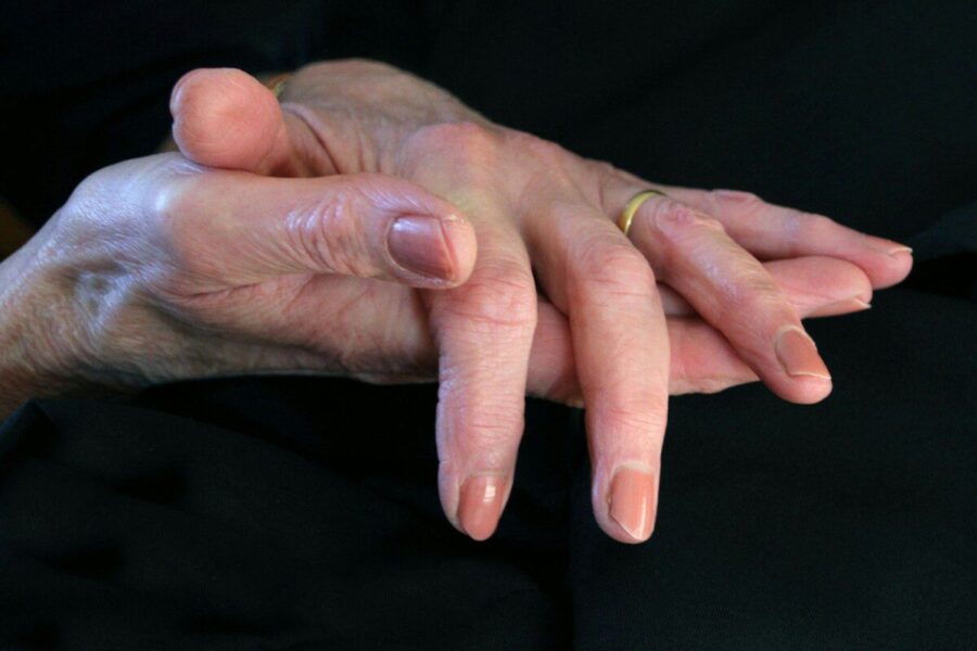 Osteoartritas ir sportas: nauja apžvalga atskleidė, ką apie mankštos naudą rodo nauja analizė