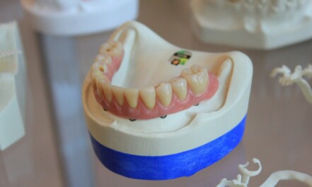 dentures on white scale rack