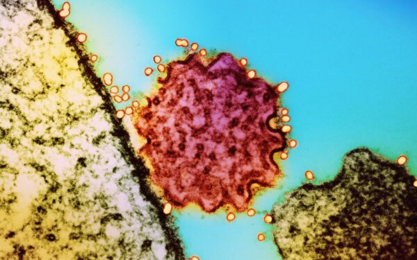 PSO skelbia naujus duomenis apie Nipah virusą, medikai perspėja dėl didelio mirtingumo