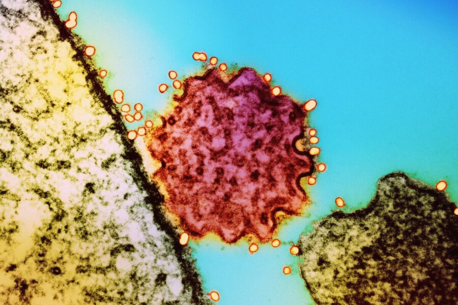 PSO skelbia naujus duomenis apie Nipah virusą, medikai perspėja dėl didelio mirtingumo