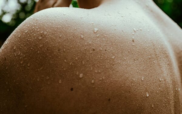 Egzemos paūmėjimas ir stresas: mokslininkai nustatė svarbų nervų ir imuninės sistemos ryšį